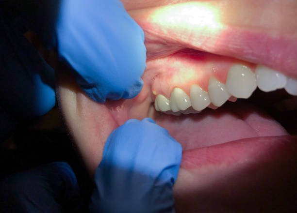 Best Urgent Tooth Repair  in Heavener, OK